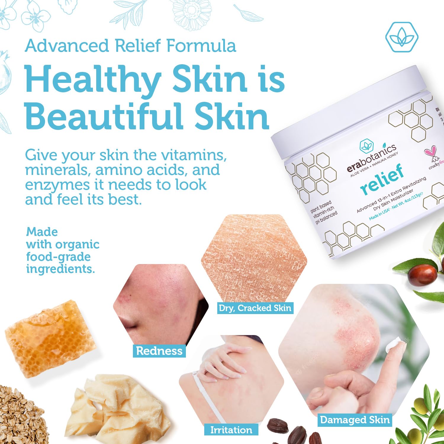 Era Organics Eczema, Psoriasis & Dermatitis Moisturizer Cream - Advanced 13-in-1 Non-Greasy Face or Body Lotion for Dry, Itchy Skin with Aloe Vera, Manuka Honey and More 4oz