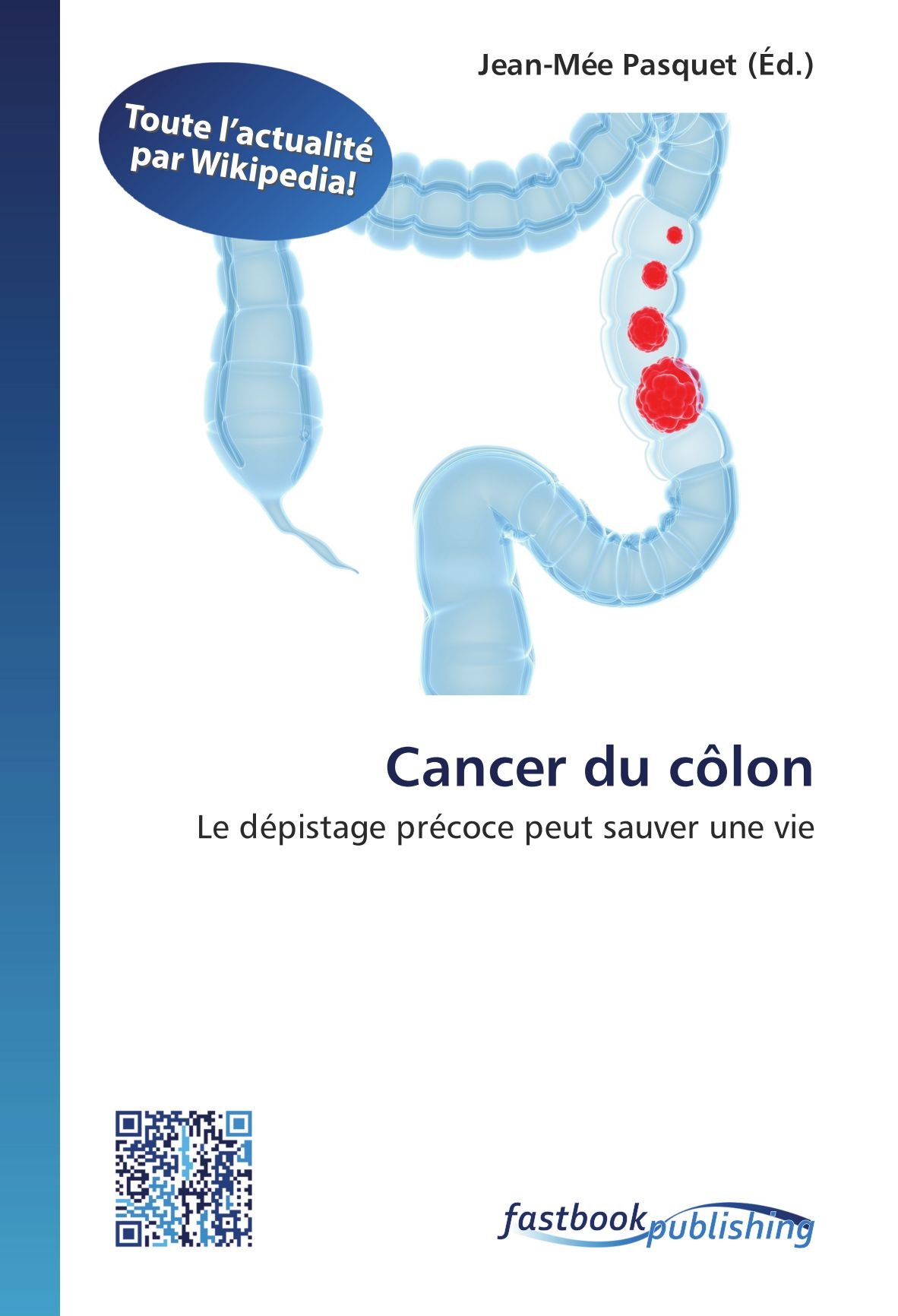 Cancer Du Colon Le Depistage Precoce Peut Sauver Une Vie French Edition Amazon Com Books