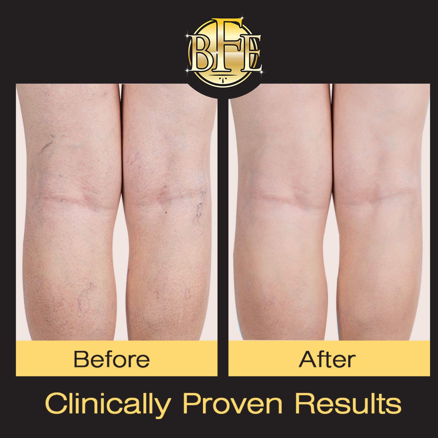 Vitamin K Cream Moisturizing Bruise Healing Formula. Dark Spot