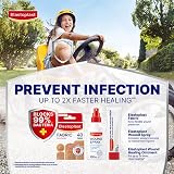 Elastoplast Extra Flexible Fabric Plasters 400 Strips 10x40 Large Breathable view 5