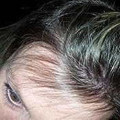 Amazon.com: Art Naturals Organic Argan Oil Hair Loss ...