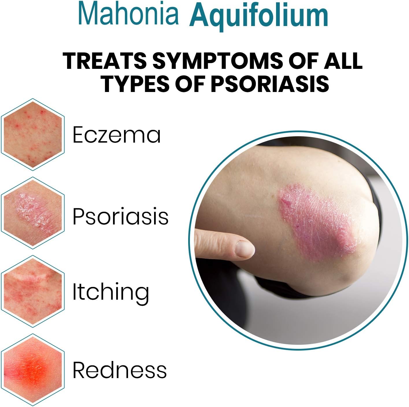 M-Folia Psoriasis Body Wash Helps to Treatment of Psoriasis, Eczema and Related Dry Skin of the Body 250ml (1x Pack) - Image 3