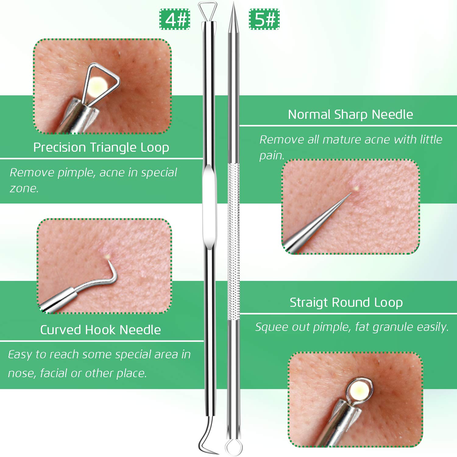 5PCS Blackhead Remover Comedone Extractor, Curved Blackhead Tweezers Kit, Professional Stainless Pimple Acne Blemish Removal Tools Kit: Beauty