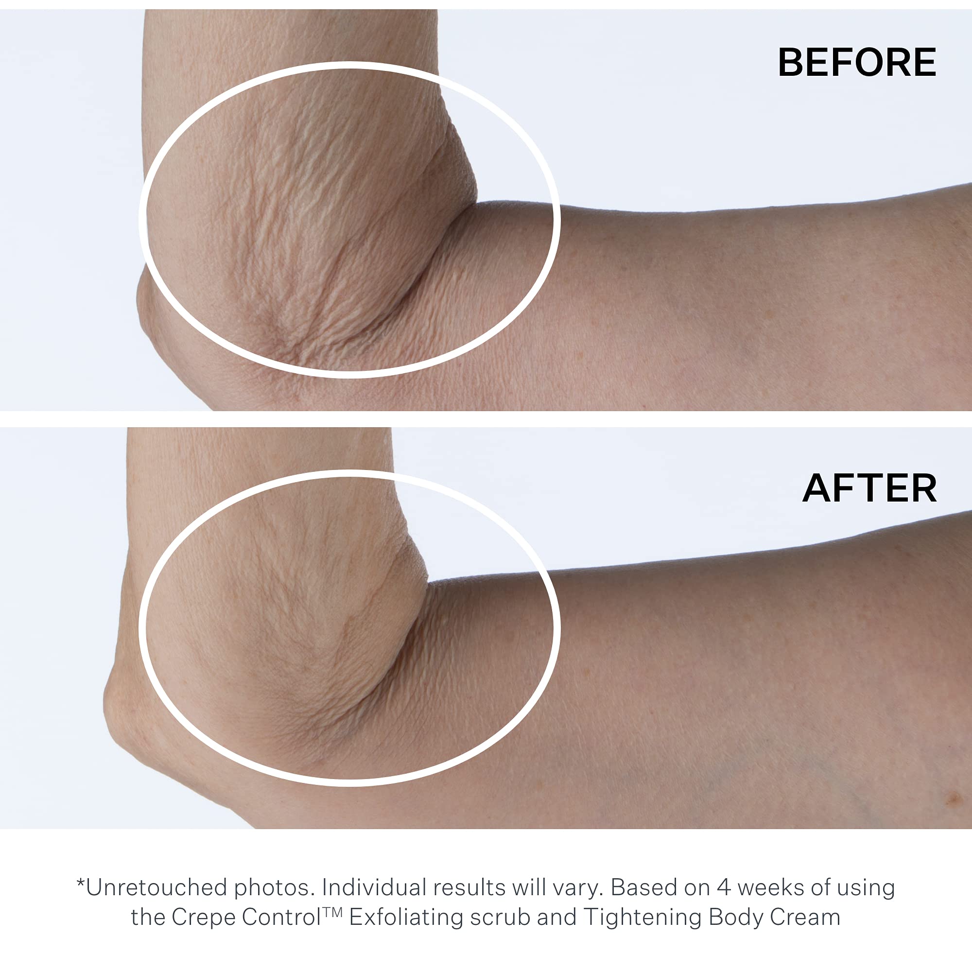 StriVectin Tighten & Lift Crepe Control Body Creams & Treatments, Improving Crepey & Saggy Skin, Hydrating Moisture for your Skin