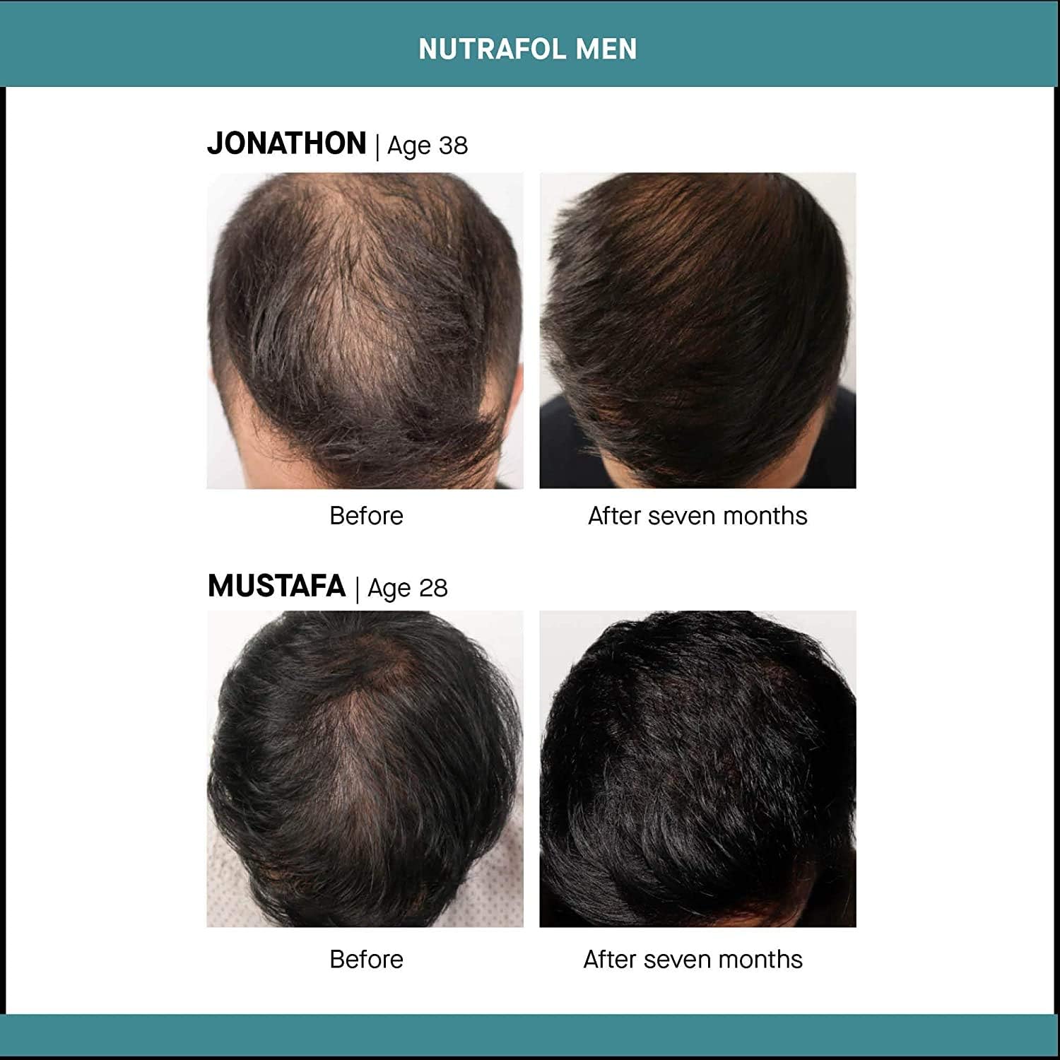 Nutrafol Mens Hair Growth Supplement for Thicker, Stronger Hair (4 Capsules Per Day - 3 Bottles - 3 Month Supply): Health & Personal Care