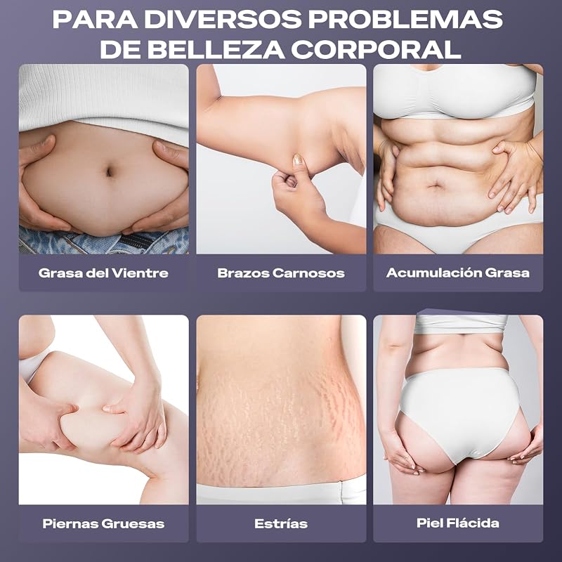 Masajeador Anticelulitico Reductor, 3 En 1 Masajeador Anticelulítico Eléctrico Profesional, Unisex Para Cintura, Vientre, Brazos, Glúteos Y Piernas