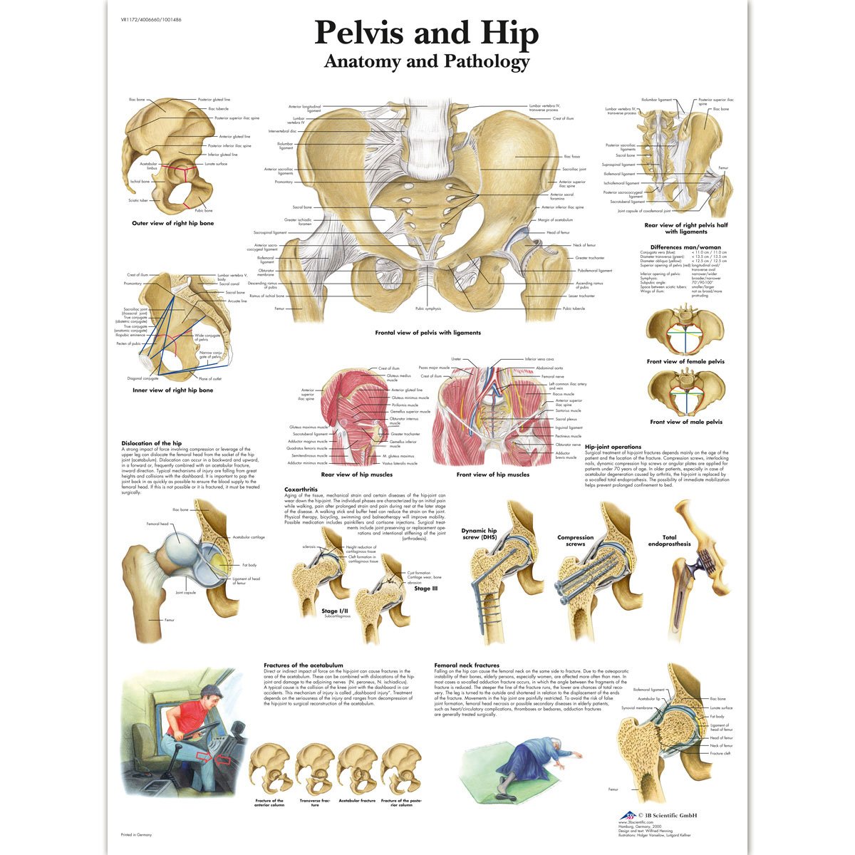 3B Scientific VR1172L Human Anatomy - Pelvis and Hip Chart, Laminated Version