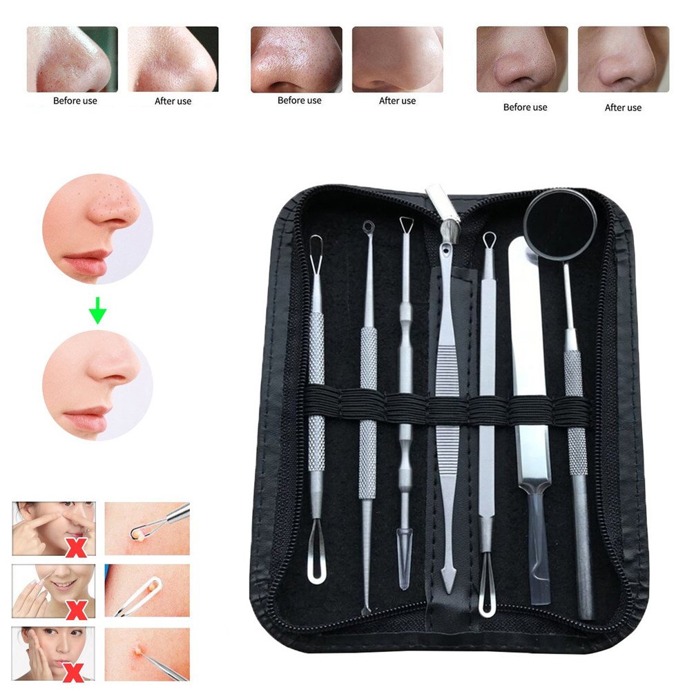 Blackhead Remover Tools, Excellent for Acne Treatment, Pimple Popping, Blackhead Extraction, Zit Removing, Blemish Removal, IOQSOF Blemish Pimple Whitehead Blackhead Acne