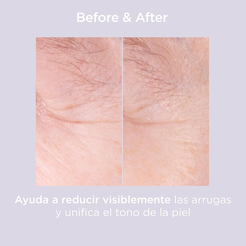 ceutics Glicoisdin 15 Moderado, Gel Facial Peeling Efeito com Ácido Glicólico, 50 ml