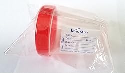 Urine Collection Container Sterile Sample Specimen