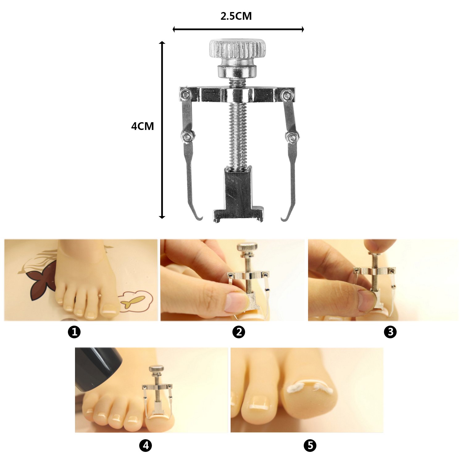 Ingrown Toenail Corrector, Ingrown Toenail Correction Tool Nail