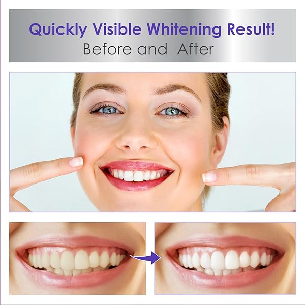 PURPLE TOOTHPASTE FOR TEETH WHITENING, PURPLE TEETH WHITENING, V34 COLOUR CORRECTOR SERUM, PURPLE TOOTHPASTE, COLOR CORRECTOR PURPLE TOOTHPASTE, PURPLE TEETH WHITENING TOOTHPASTE