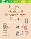 Flaps in Plastic and Reconstructive Surgery