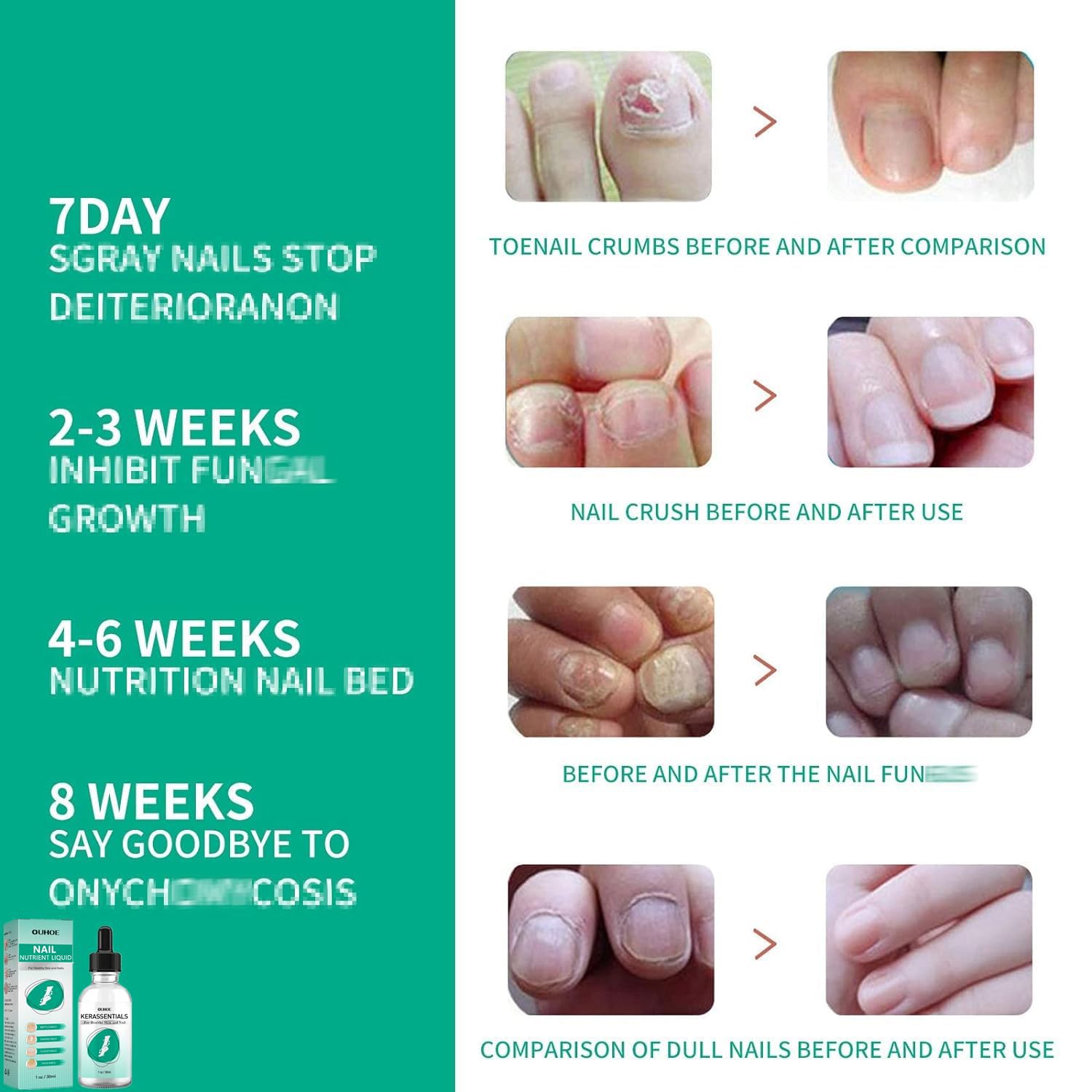 Kerassentials Toenail Oil, Kerassentials Nails colourless (3PCS) - Image 2