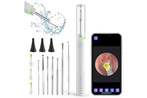 WONVON Ear Scope, Ear Wax Removal Tool Camera Wireless Otoscope 1080P Ear Cleaner Camera, Otoscope with Light Ear Wax Remover, Ear Endoscope Compatible for iPhone iPad Android