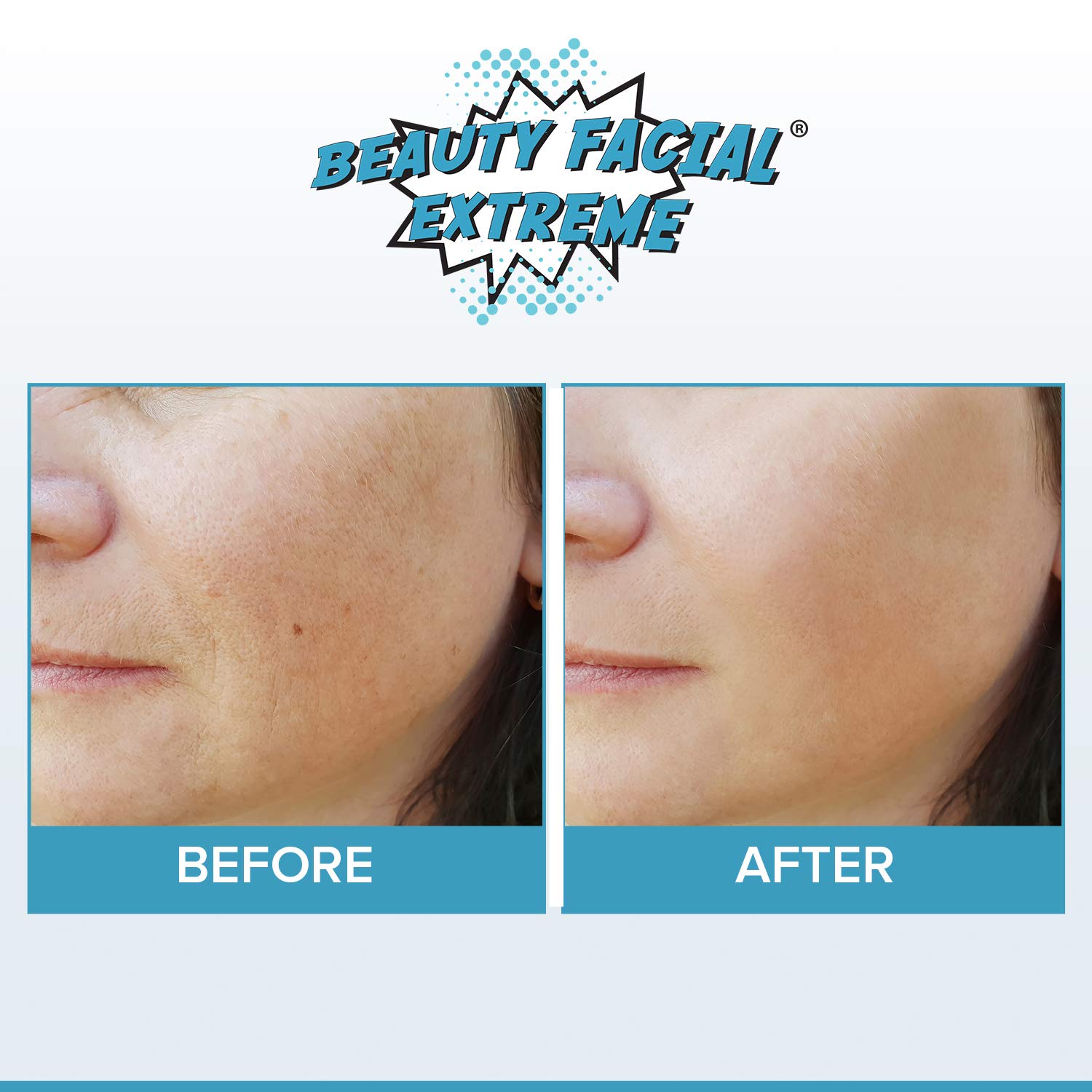 Anti Aging Resurfacing Chemical Peel Pads- Contains Lactic Acid, Salicylic Acid & Glycolic Acid for Face & Body. Repairs Fine Lines, Wrinkles, Dark Spots, Pores, Scars & Uneven Skin Tone.: Beauty