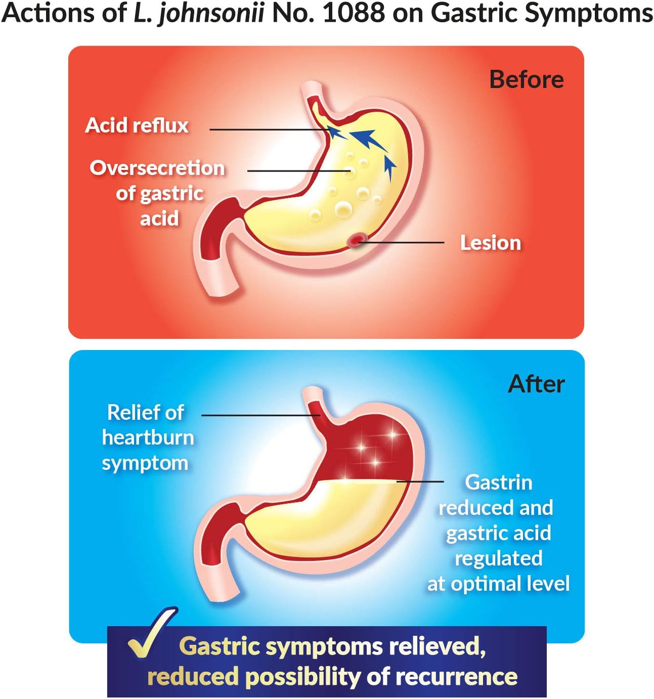 GASTRICELL - Eliminate H. Pylori, Relieve Acid Reflux and Heartburn, Regulate Gastric Acid - Targets The Root Cause of Recurring Gastric Problems, Natural Defence Against Gastric Distress -30 sachets: Health & Personal Care
