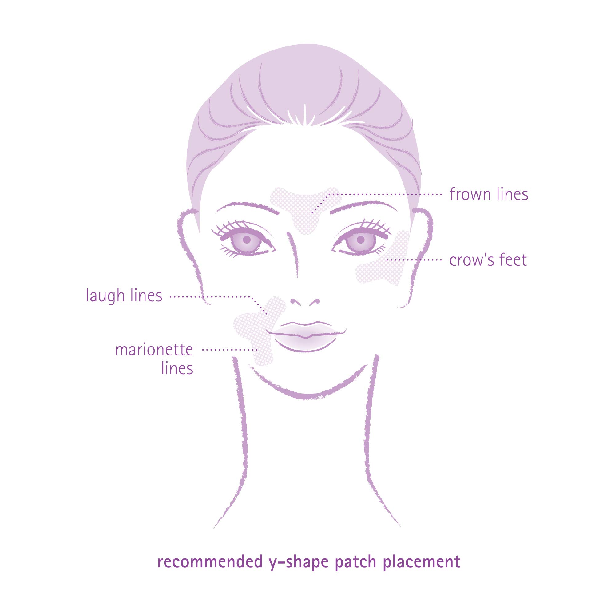 Toute Nuit Wrinkle Patches – Y Shape – Face Tape for Forehead, Between the Eyes & Around Mouth – Hypoallergenic Anti Wrinkle Patches – 20 Count, Made in USA