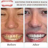 VEGCOO 4 Pairs Cosmetic Veneer False Teeth Comfortable Natural Smile view 3