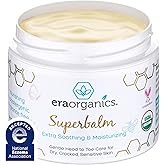Era Organics Healing Ointment for Babies - USDA Certified Organic Natural Moisturizer Gentle on Sensitive Skin Prone To Baby Eczema, Cradle Cap (Infant Seborrheic Dermatitis), Rashes, Hives and More