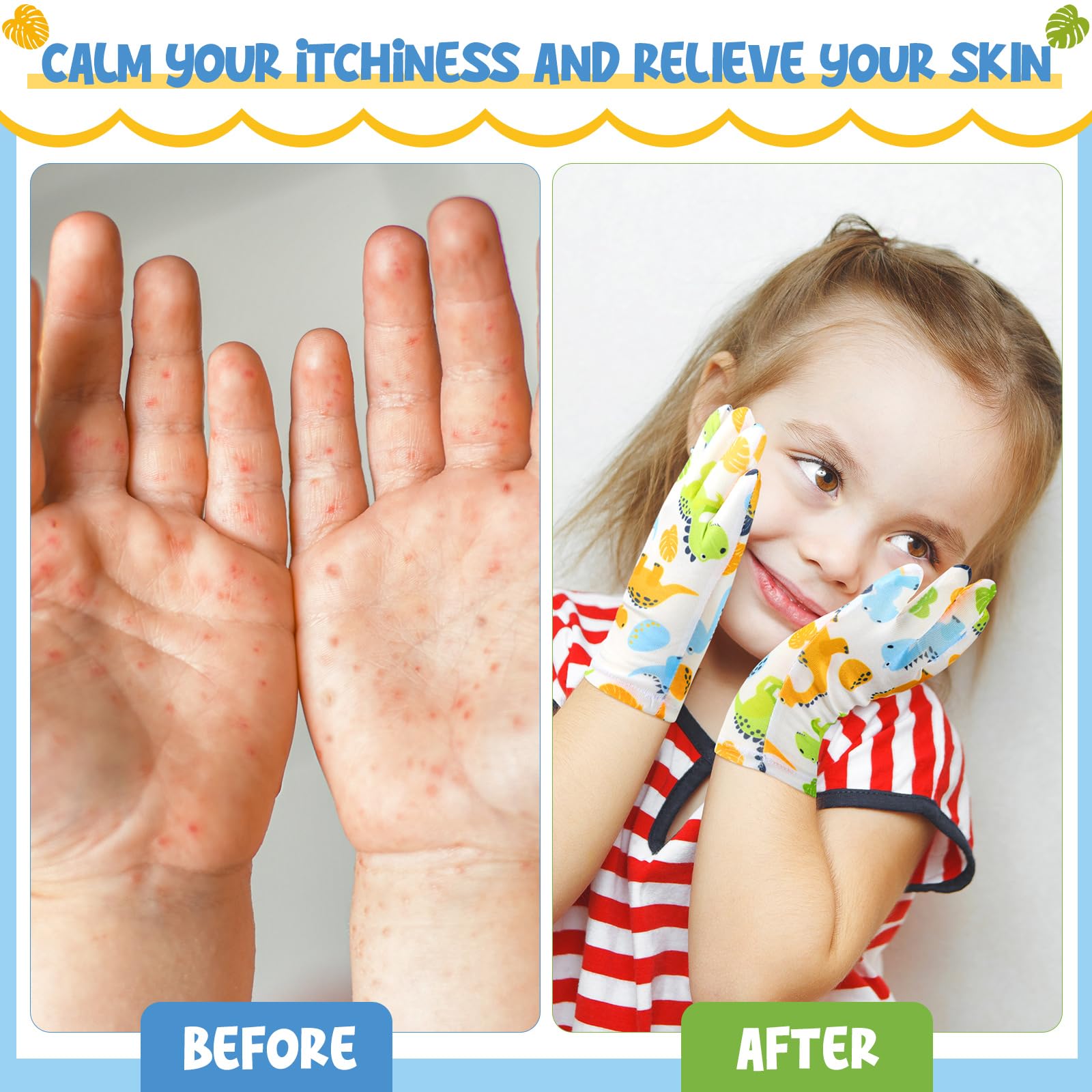 Xtinmee 20 Pairs Eczema Gloves for Kids Cotton Moisturizing Gloves for Sensitive Irritated Skin Eczema Reusable Elastic Hand Cover Soft and Does Not Hurt(Age 3-4 Years)