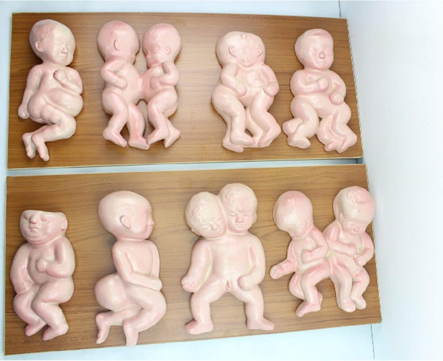 Amazon Co Jp 胎児モデル 婦人科医療家族計画ディスプレイ教材用の奇形乳児シャム赤ちゃんデモンストレーションモデル 8個セット ホーム キッチン