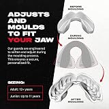 SafeJawz Mouthguard for Braces One Size Re-mouldable Gum Shield with Case view 2