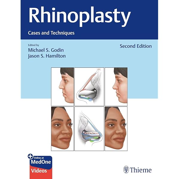 Grabb And Smith's Plastic Surgery: 9780781746984: Medicine