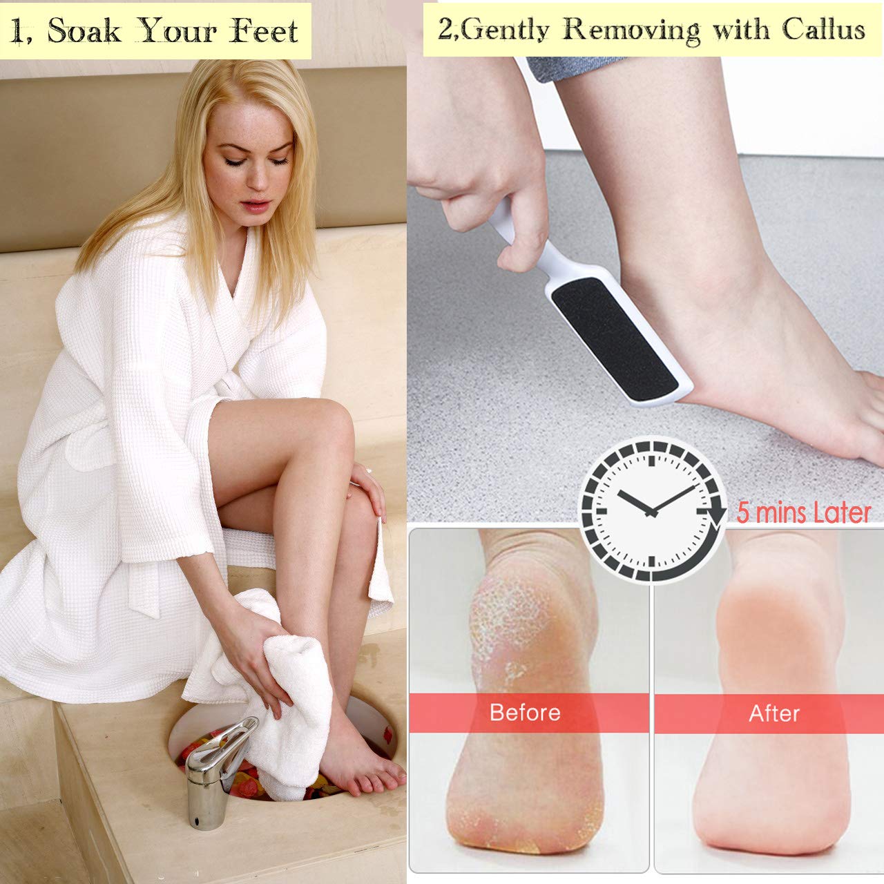16 PCS Foot File Professional Pedicure Tools Set, Yotako Foot Spa Kit Callus Remover Scrubber, Exfoliating Pedicure Supplies and Nail Toenail Clipper Foot Care Kit : Beauty