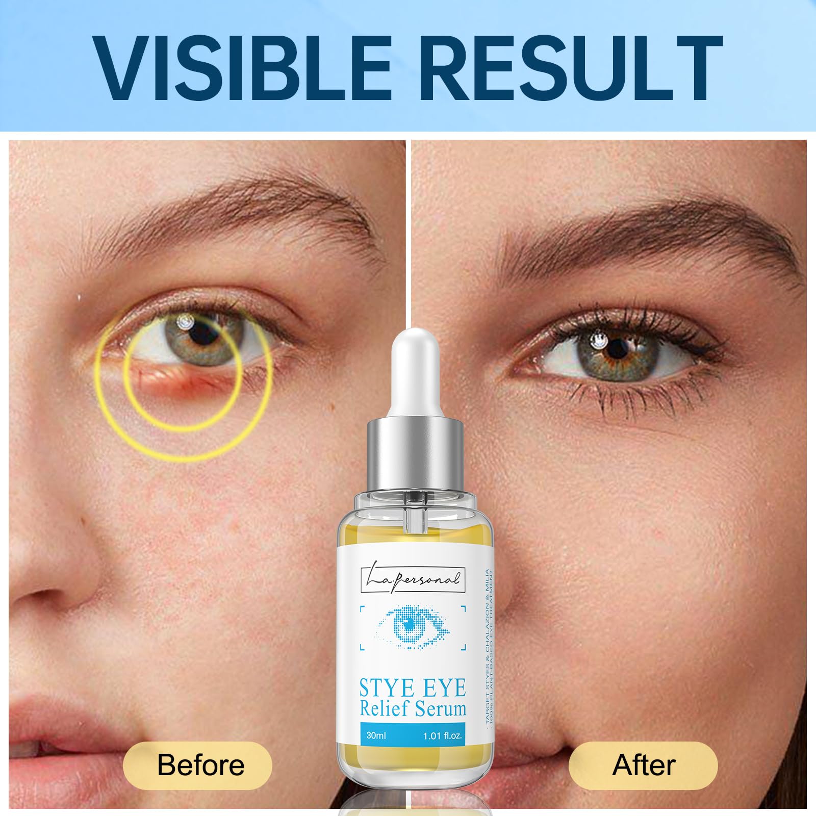 LA.PERSONAL Caffeine Eye Serum, Eye Relief Serum for Reducing Irritation, Moisturizing 1.01 Fl oz/30 Ml