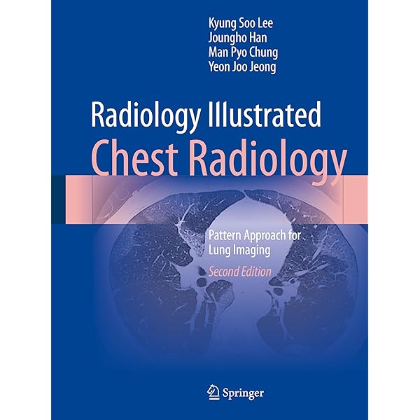 Radiology Illustrated: Chest Radiology: Pattern Approach for