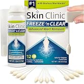 Skin Clinic Freeze 'n Clear Advanced Wart Remover - USA Made Cryo-Freeze Kit with 12 Precision-Tip Applicators - FDA-Cleared Freezing Wart Treatment Solution for Adults &amp; Kids 4+