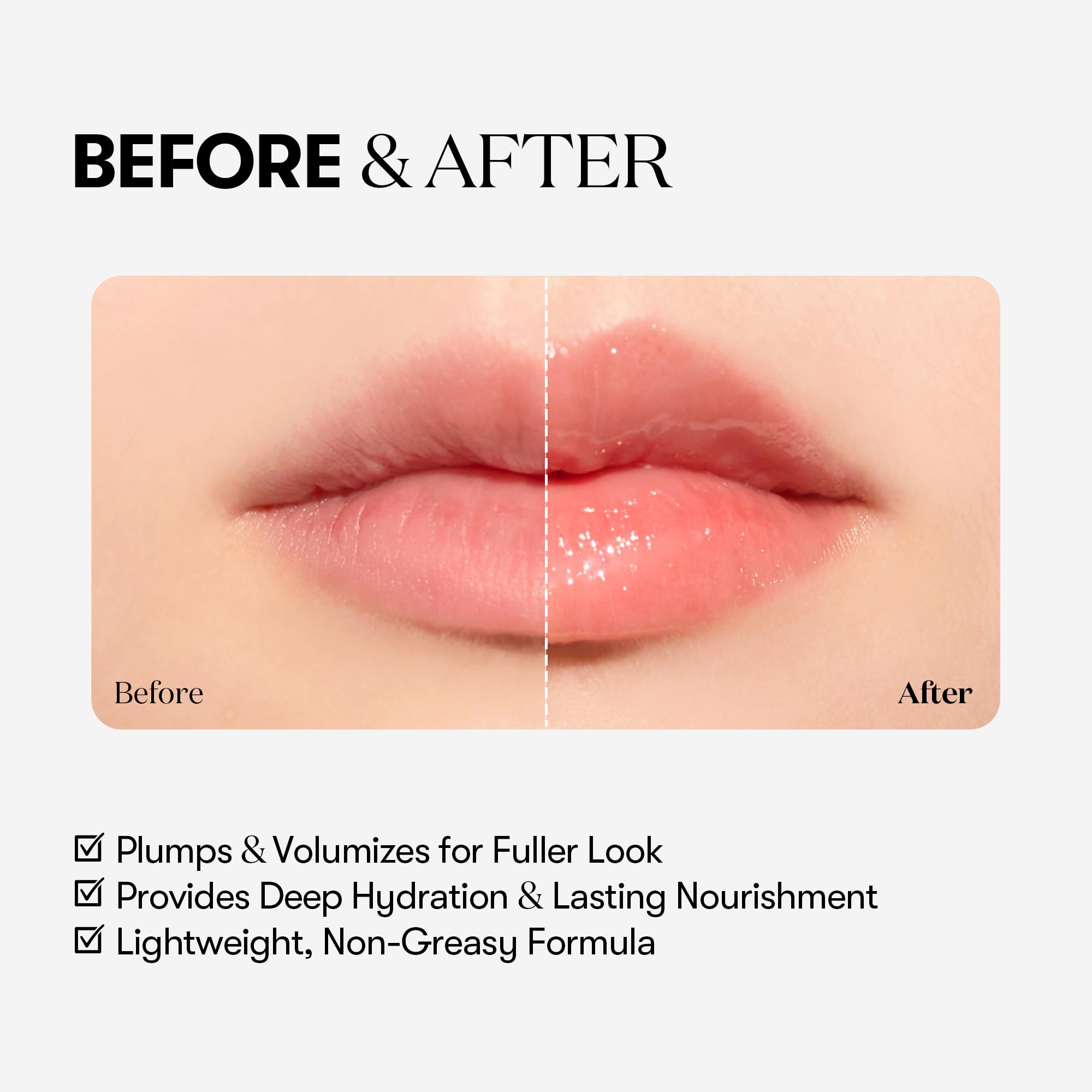 VTCOSMETICS Reedle Shot Lip Plumper, 0.15 oz (4.3 g), Moisturizing, Transparent, Lip Gloss, Fragrance-free, Korean Cosmetics (Expert)