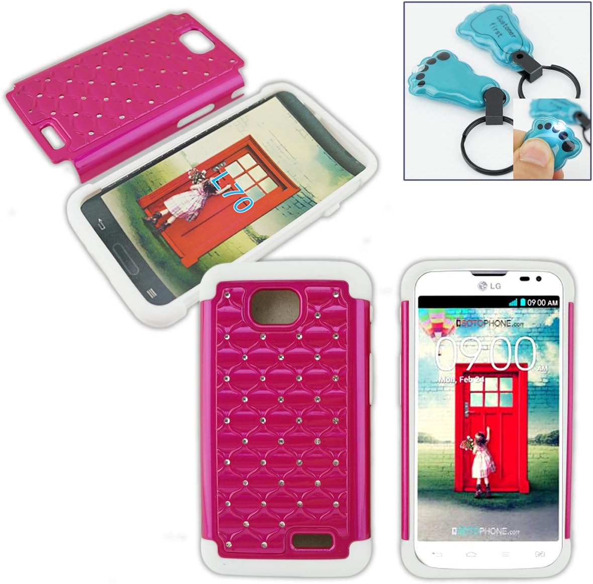 Best Lg Ultimate 2 Phone Case Black