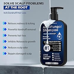 Antifungal Shampoo for Seborrheic