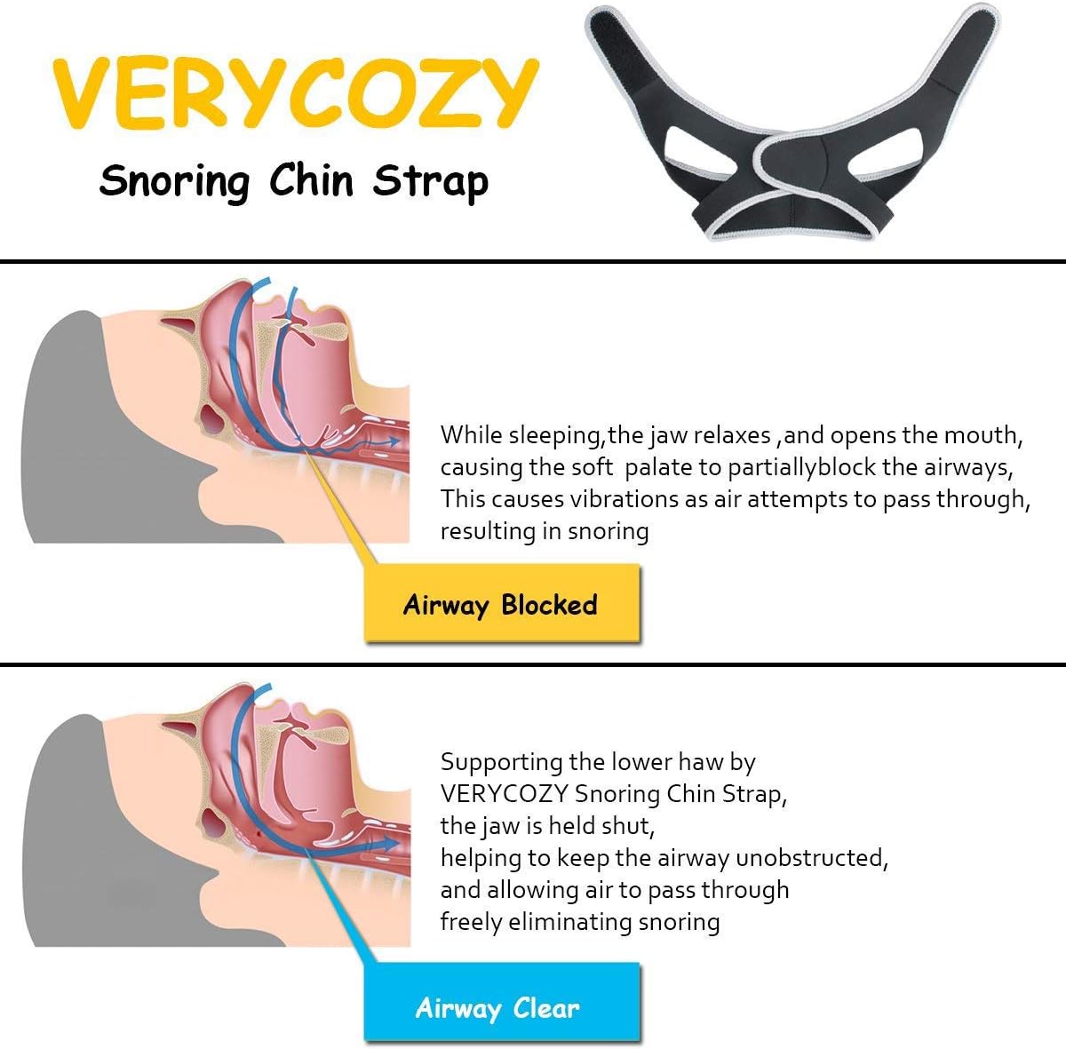 Anti My Snoring Snore Solution, Anti Snoring Snore Chin Strap Large, Anti Snore Snoring Chin Strap Devices for Men Women Kids, Snore Stopper Chin Strap, Resmed Cpap Supplies Chin Straps: Health & Personal Care