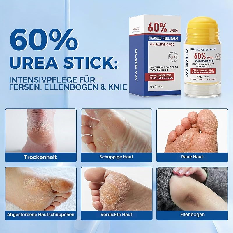 Urea Creme Stick mit 60% Urea & 2% SA, Intensiv Pflege Stick für raue, trockene Haut an Fersen, Füßen, Ellbogen & Knien, Feuchtigkeitsbalsam für glattere Haut, 40g