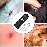 EasyULT 3Pcs Tick Remover Tool Set Stainless Steel Tick Hook Tweezers Kit view 8