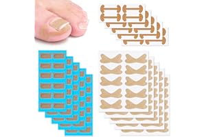 130Pcs Ingrown Toenail Corrector Patch, 3 Types Professional Ingrown Toenail Tool for Toenail Care Protect Toe Nail, Effectiv