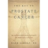 The Key to Prostate Cancer: 30 Experts Explain 15 Stages of Prostate Cancer