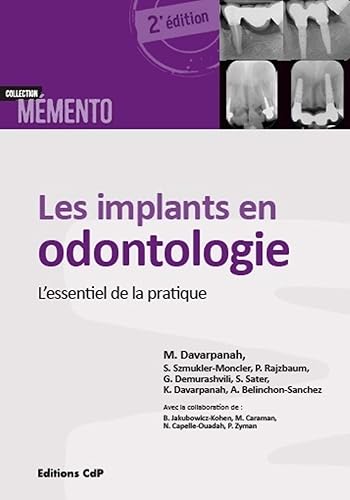 Download Les implants en odontologie: L'essentiel de la pratique. PDF