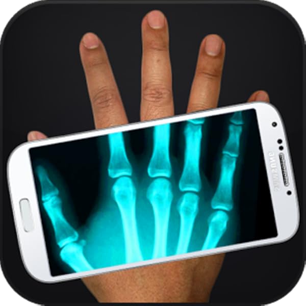 Amazon Com Xray Scanner Hd Appstore For Android Amazon Com Xray Scanner Hd Appstore For Android