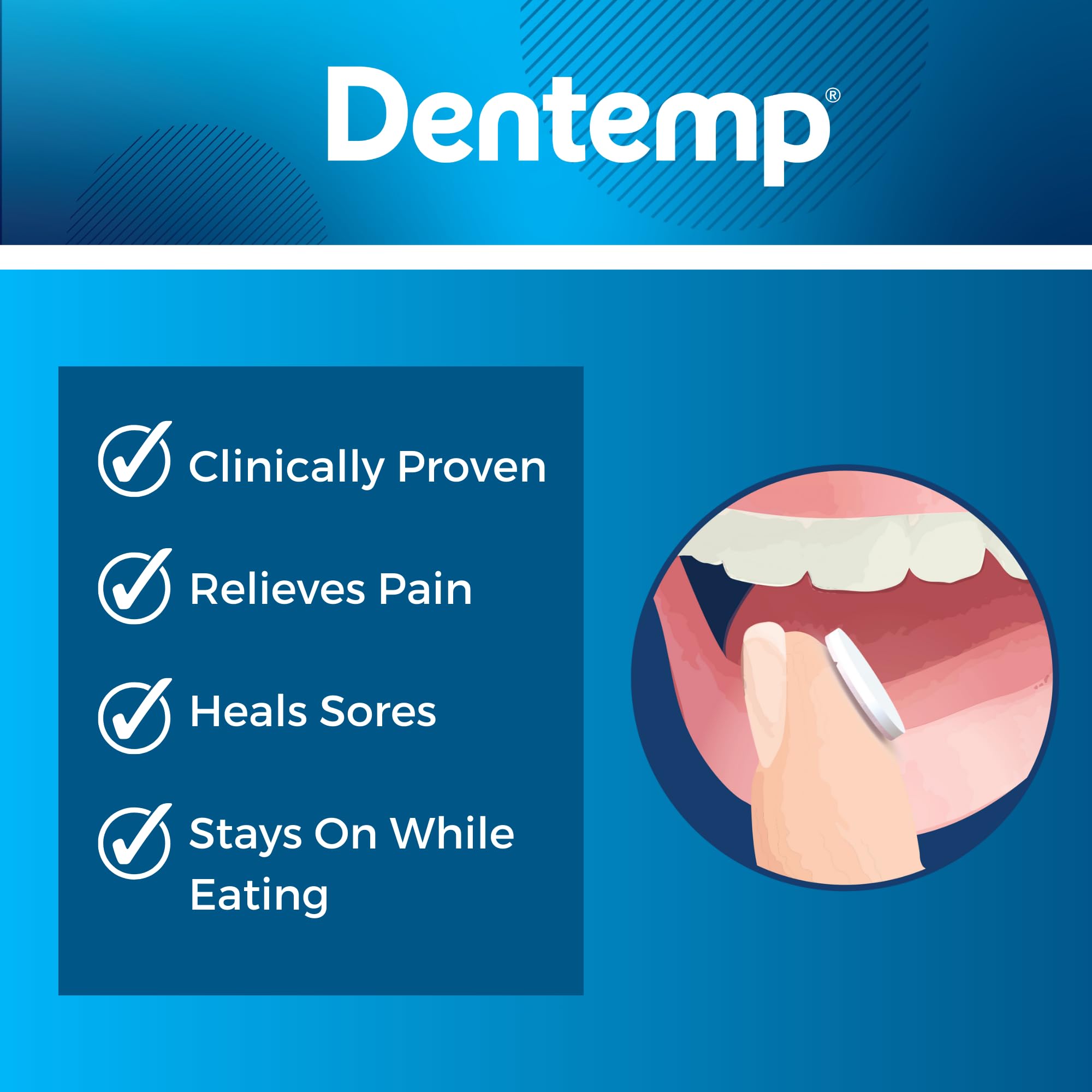 Dentemp Canker Sore Medicine 2pk Canker Cover - Oral Pain Reliever (12 Count) - Treatment to Relieve Canker Pain, Mouth Sores & Mouth Irritation - Fast Acting Canker Sore Relief Tablets for Adults