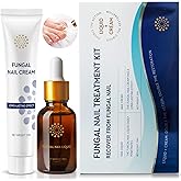 Toenail Fungus Treatment Extra Strength: Nail Fungus Treatment for Toenail and Fingernails - Fungus Nail Treatment Liquid 15ML and Anti-fungal Nail Repair Cream 20g Plant Extract Ingredients