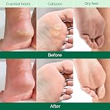 Plantifique Foot Peel Mask 2 Pairs Exfoliating Dermatologist Tested Aloe view 3