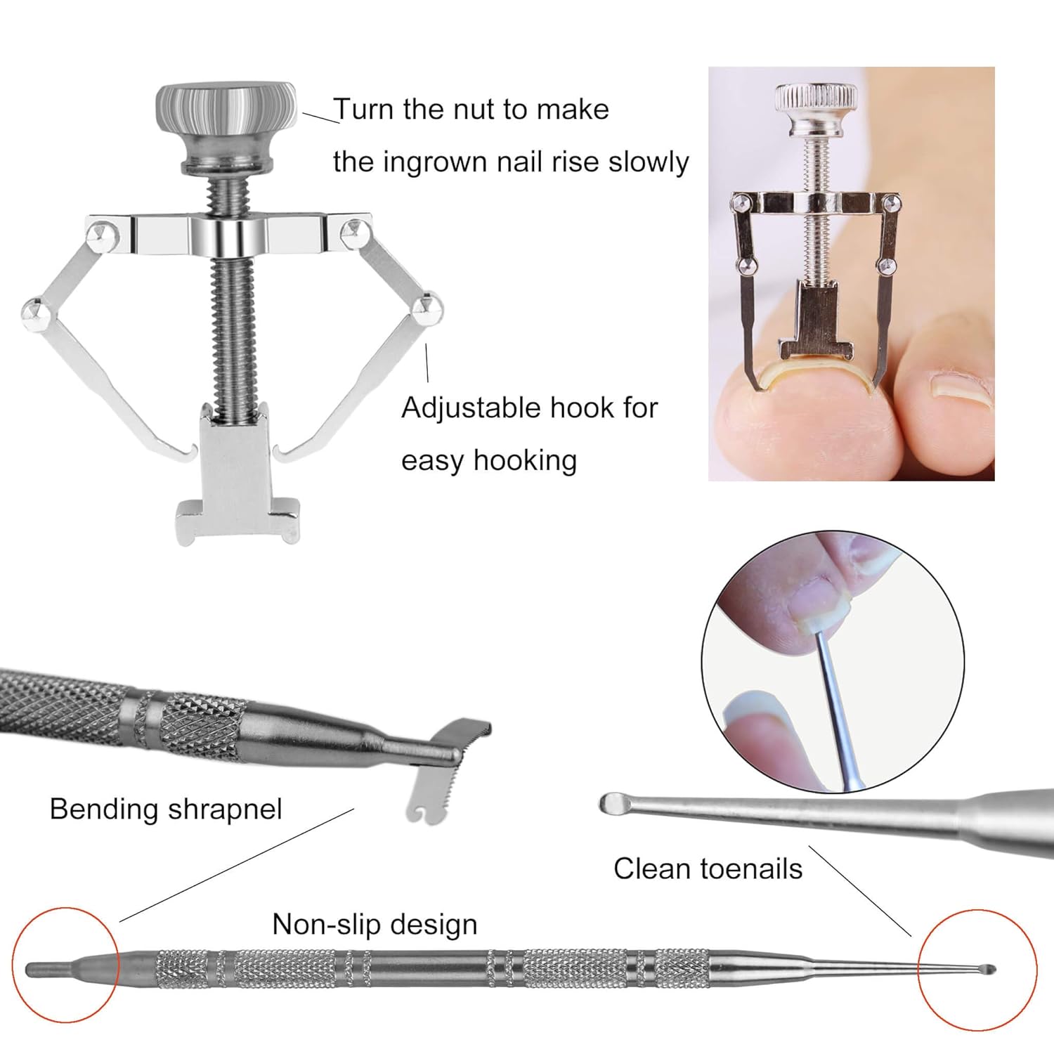 Ingrown Toenail Tool, 47 Pieces Ingrown Toenail Corrector and Lifter Toe Nail Correction Buckle Kit With Sticker for Professional Treatment (M): Beauty