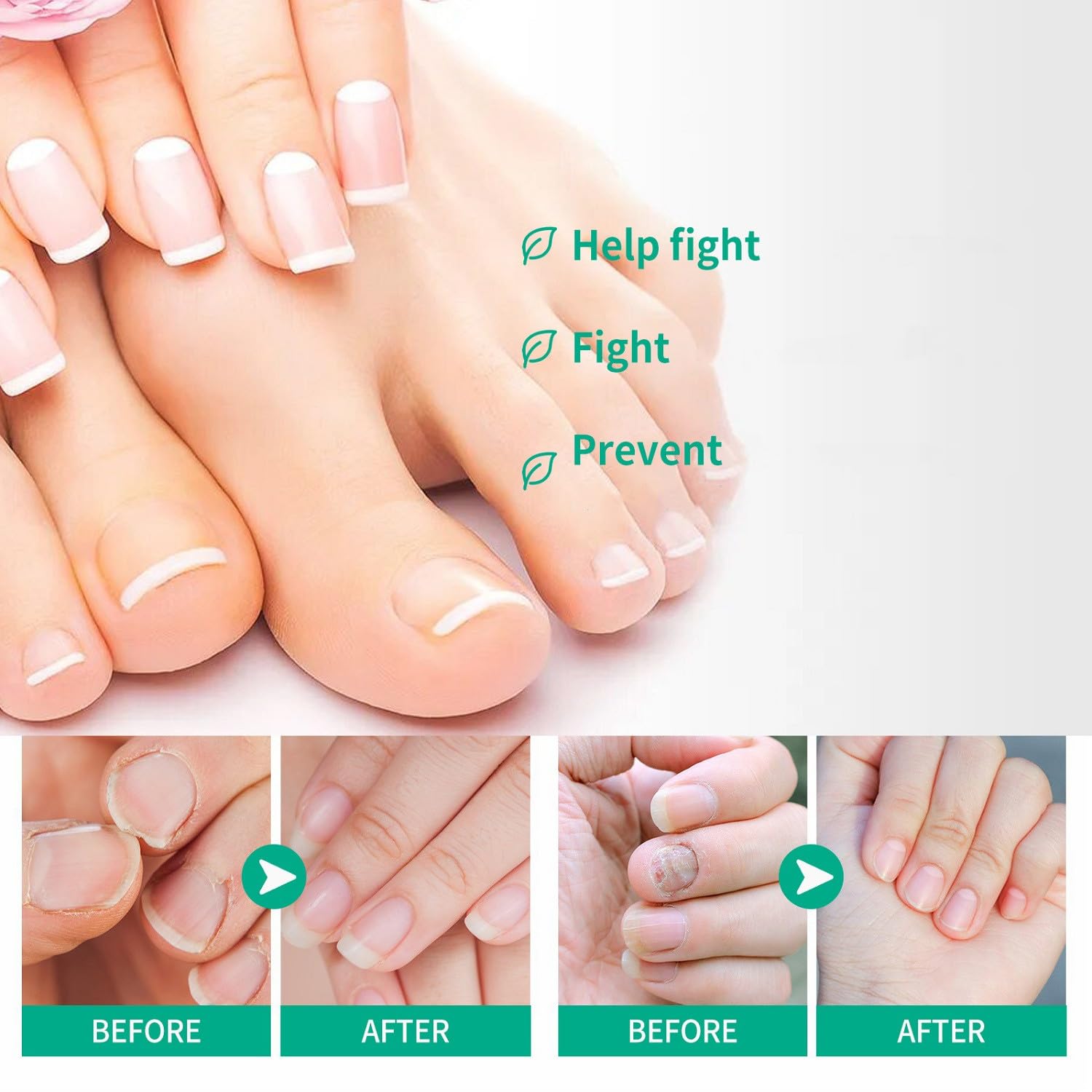 3PCS Toenail Oil, Repairing Liquid, Natural Toenail Oil for Nails(30ml) - Image 4