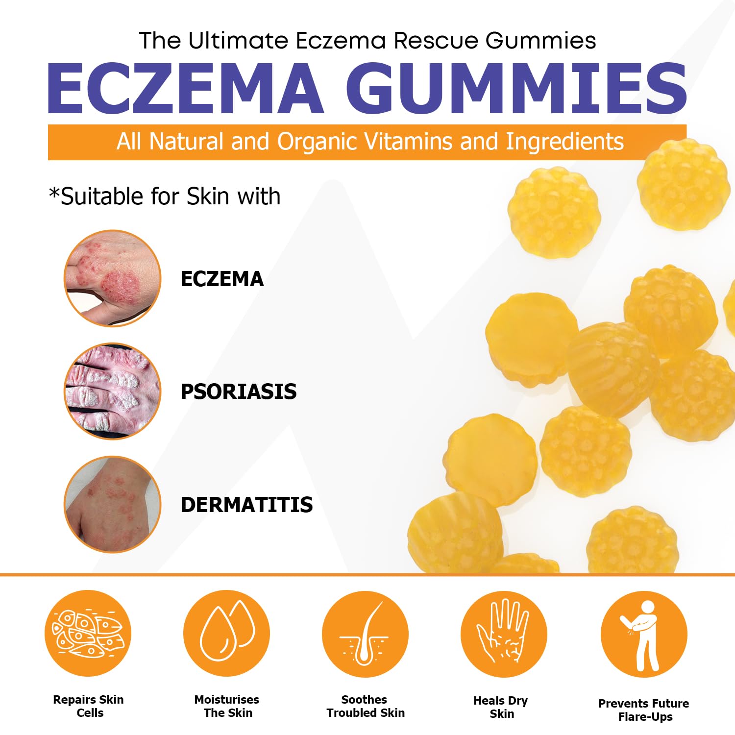 Naturevite Sugar-Free Eczema Treatment Gummies — USA-Made, 10x Effective, 20+ Vitamins Support Eczema Treat, Psoriasis, Rosacea & Dermatitis — Healthy Skin, Soothes Itching & Redness (60 Gummies)