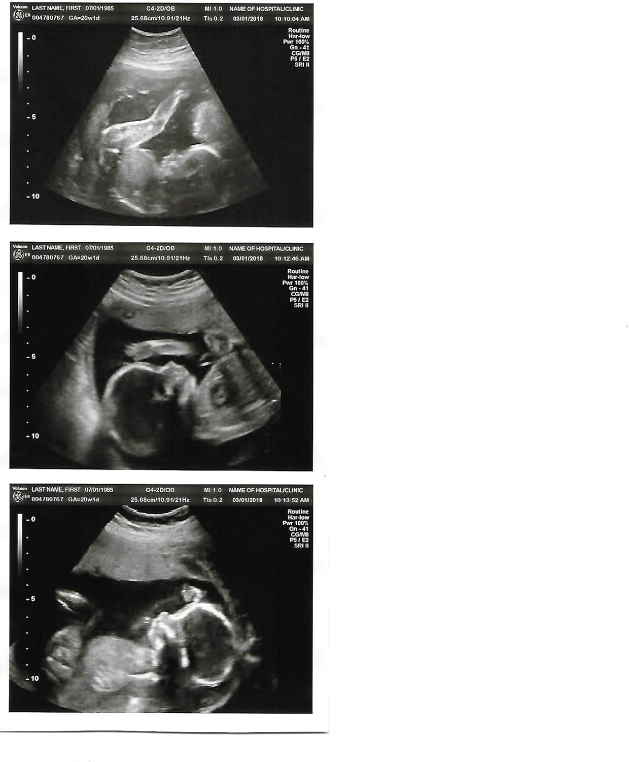 Photographs - Prank 2D Customized Fake Ultrasound Strip of 3 Photos