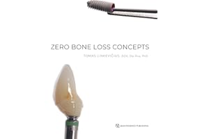 Zero Bone Loss Concepts